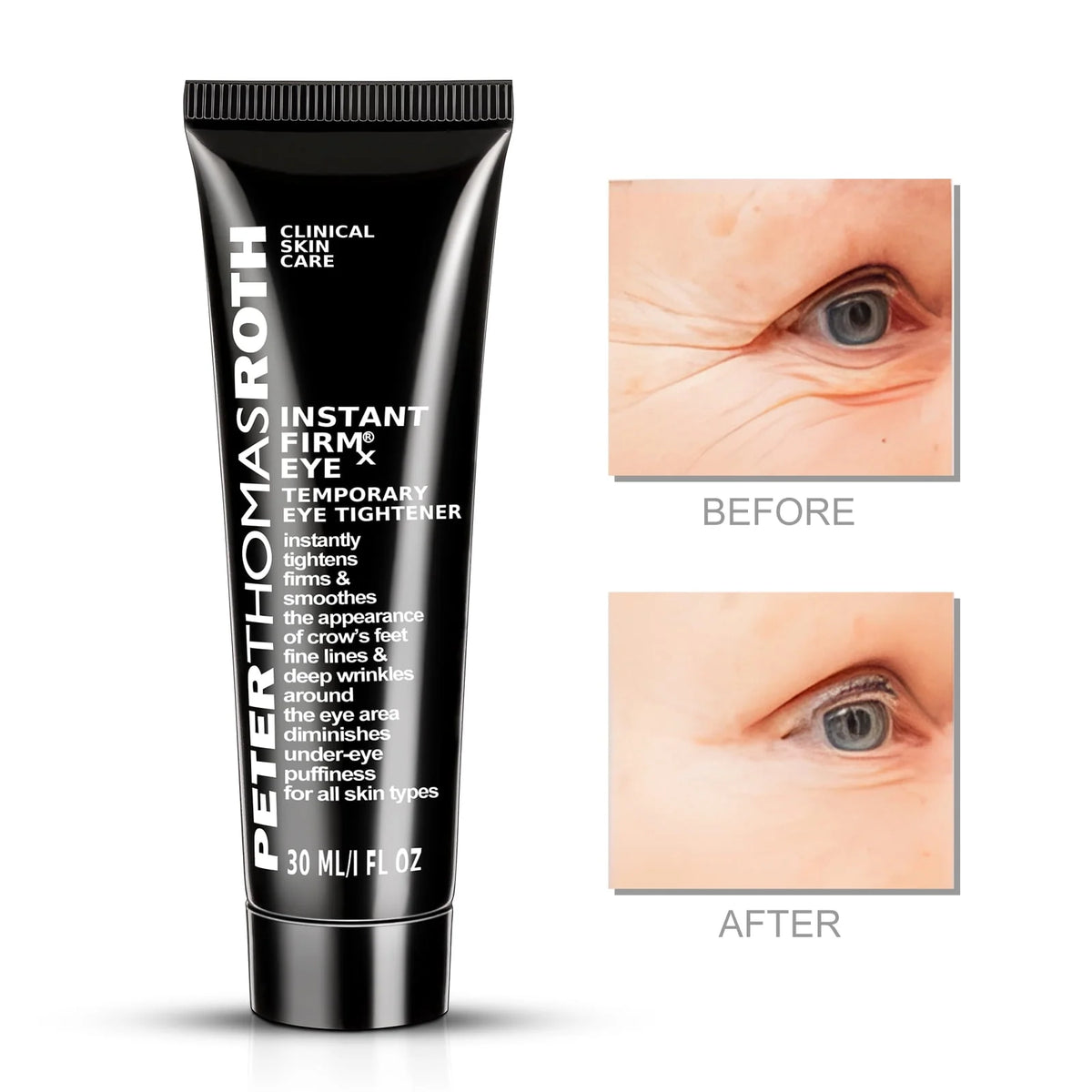Instant FirmX Eye 1 oz I37692